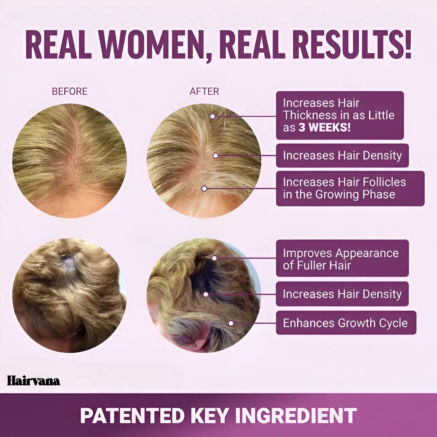 Lustiva Hair Growth Accelerator